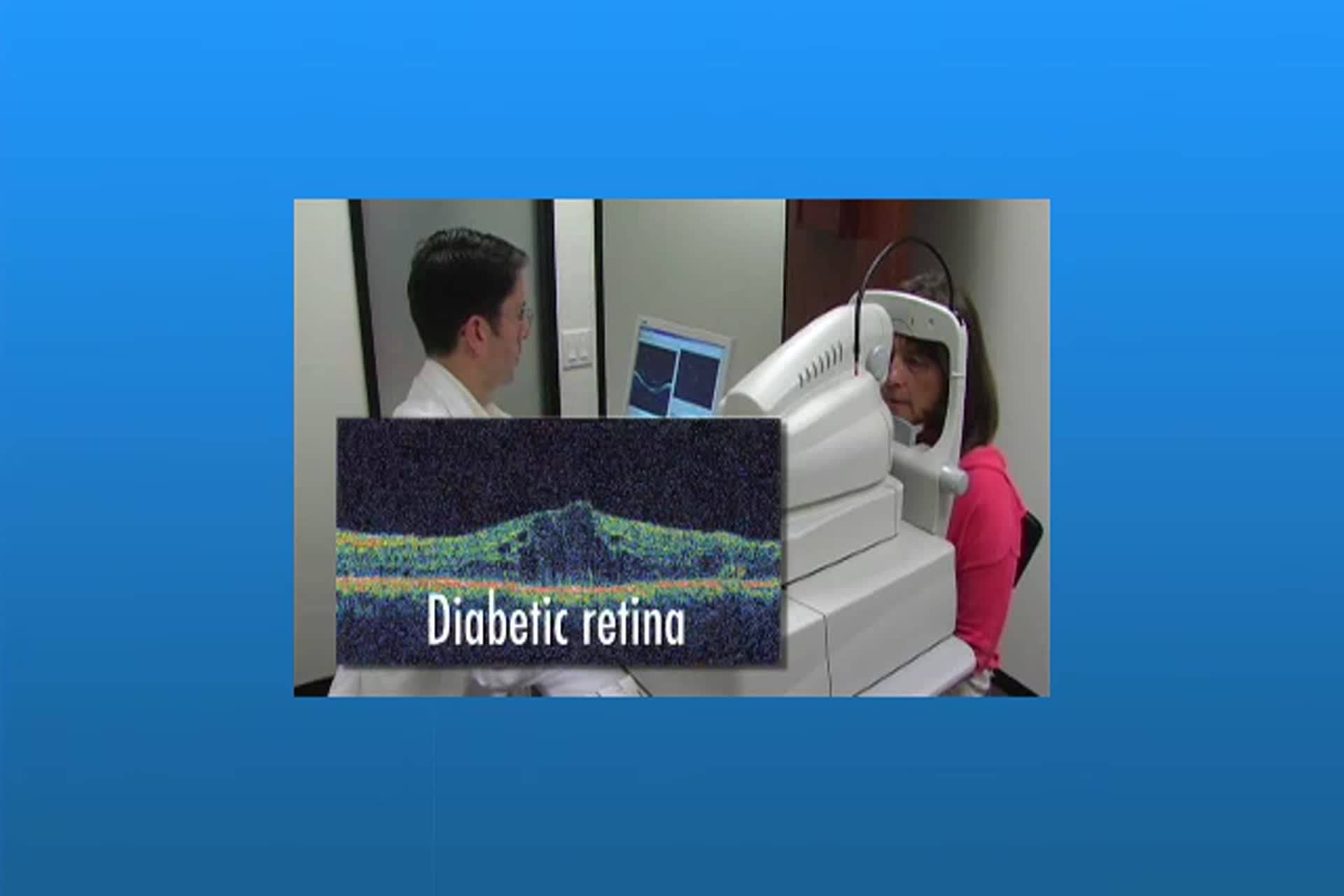 Diabetes - Optical Coherence Tomography (OCT)