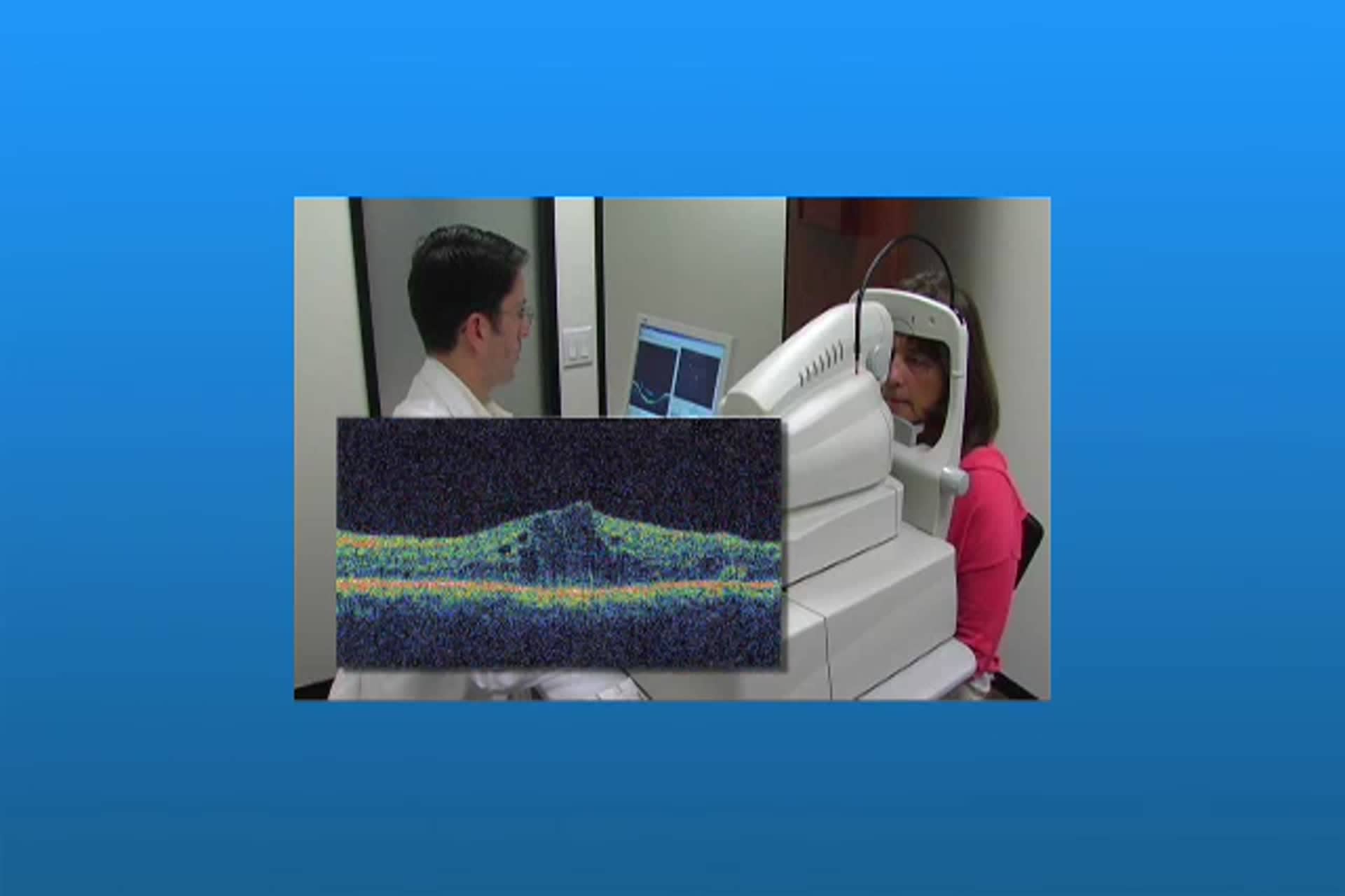 Diabetes - Tomografía de Coherencia Óptica (OCT)