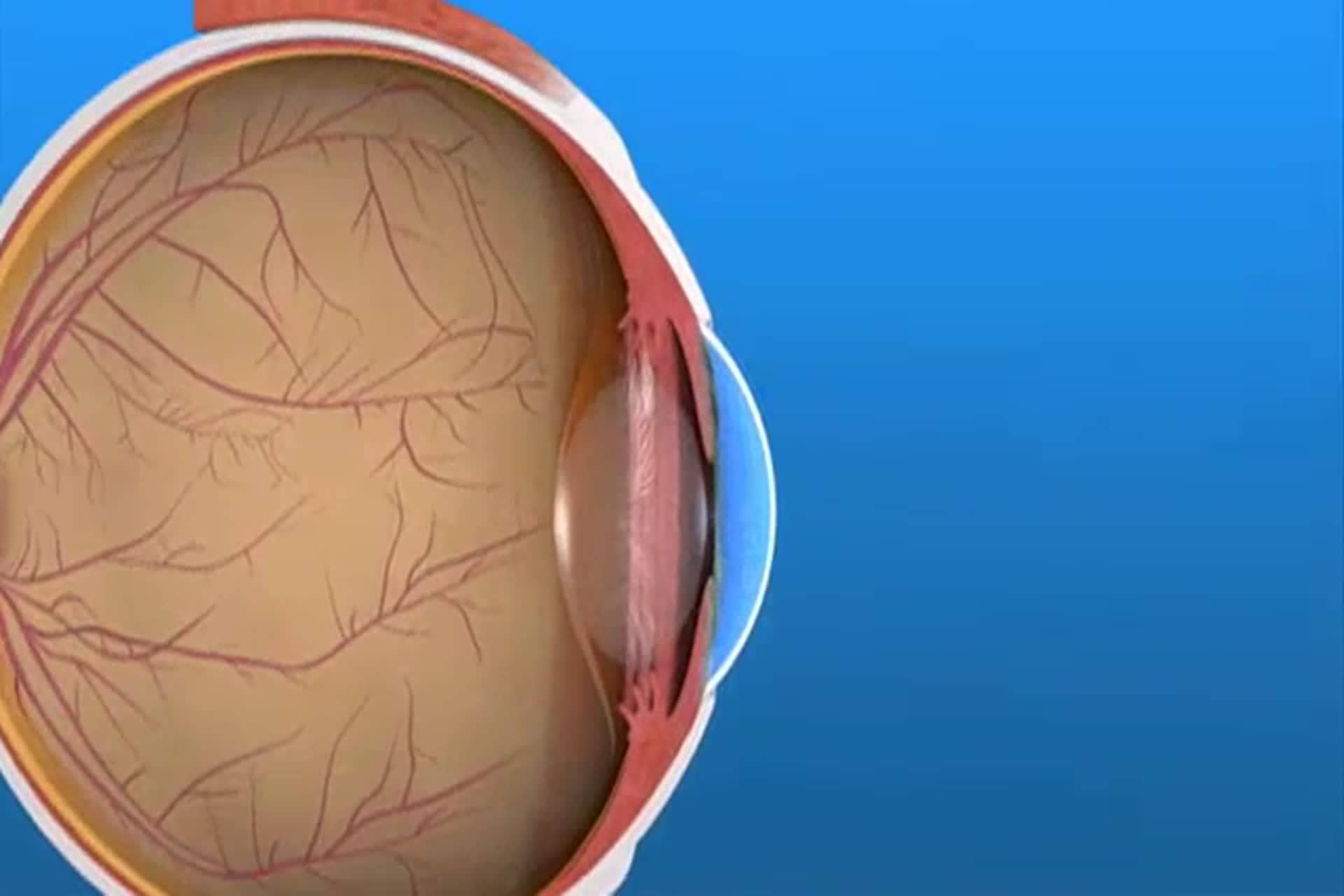 Ojo Seco - ¿Cuáles son las capas de la película lagrimal?