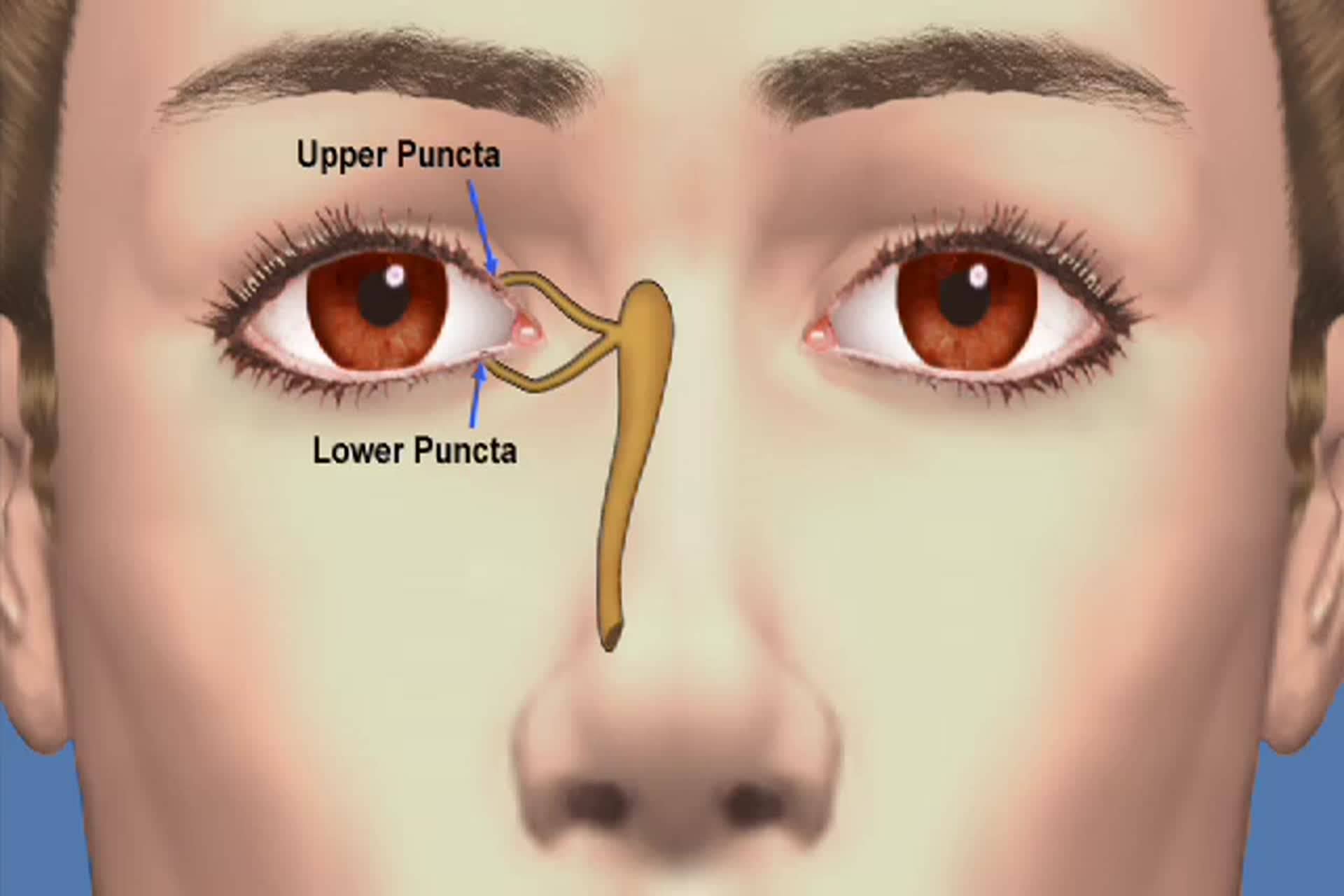 Ojo Seco - ¿Cómo se trata el ojo seco?