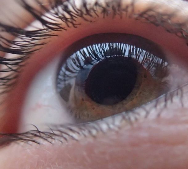 Diagnóstico y tratamiento del glaucoma