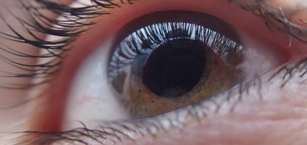 Diagnóstico y tratamiento del glaucoma