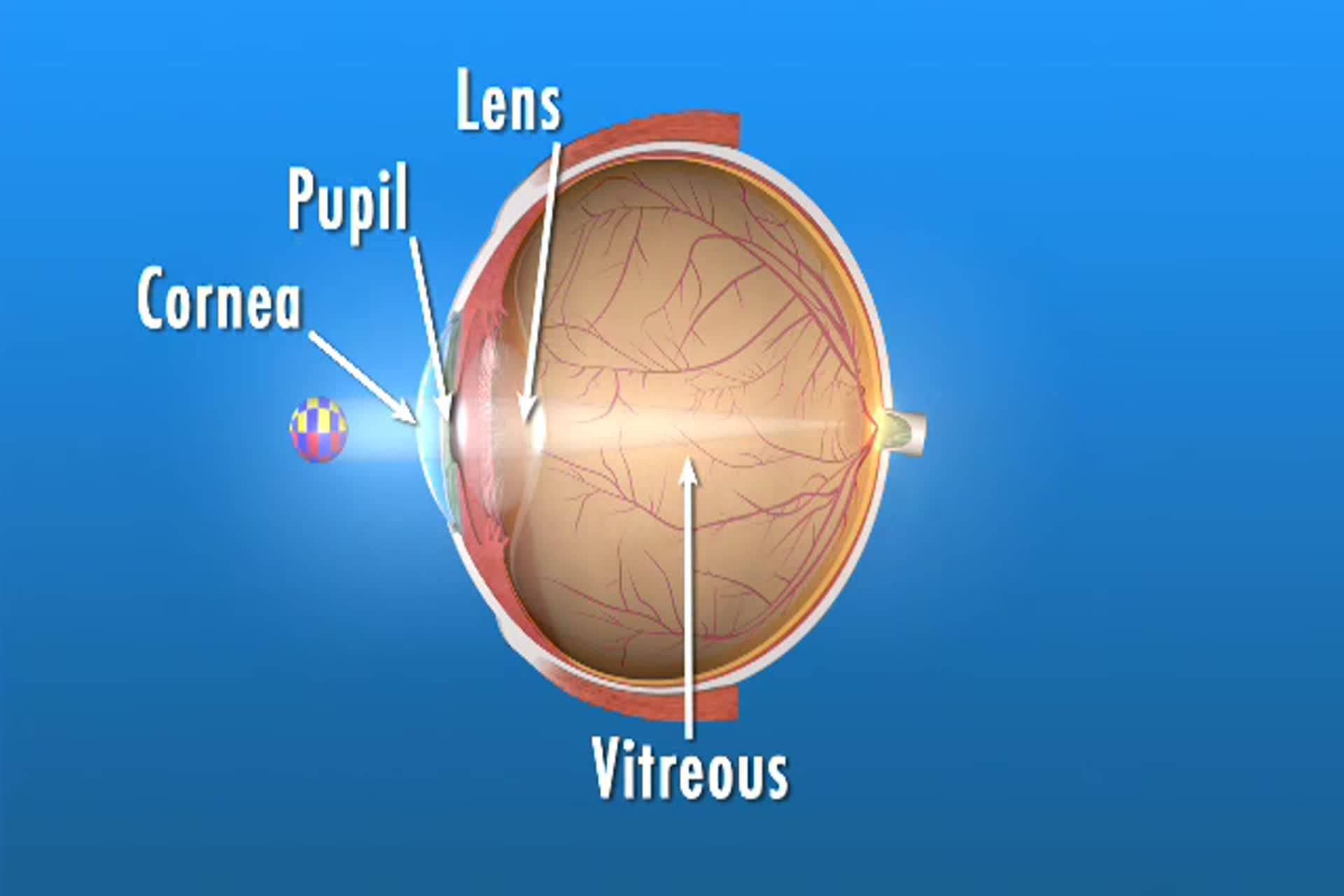 Diabetes - How are eyes affected by diabetes?