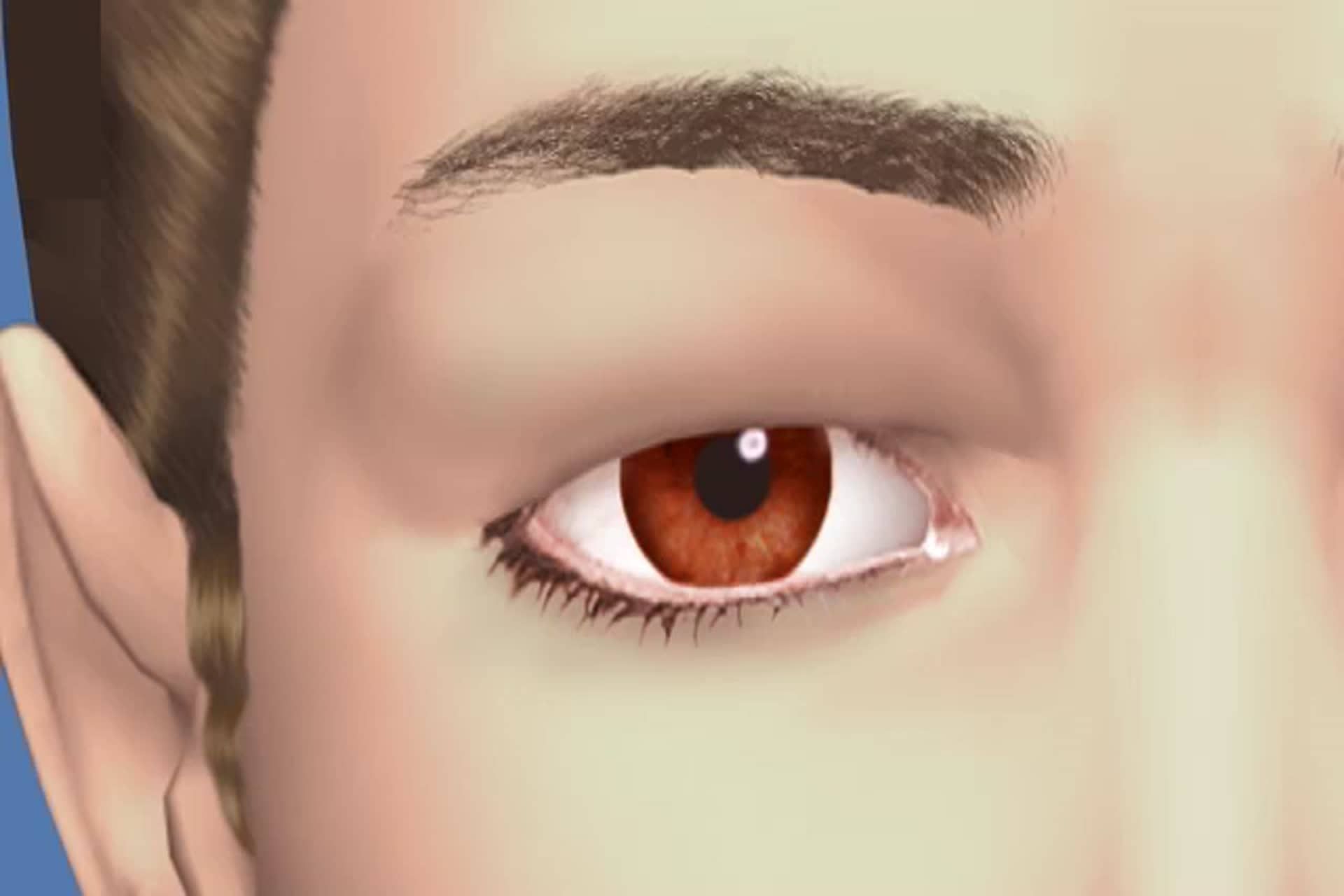 Eyelid - What causes drooping of the eyelids?