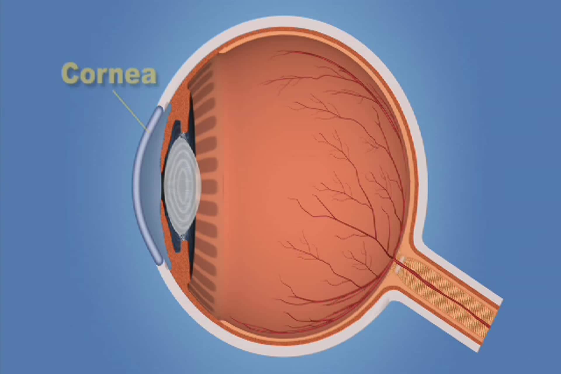 Glaucoma - How do my eyes see?