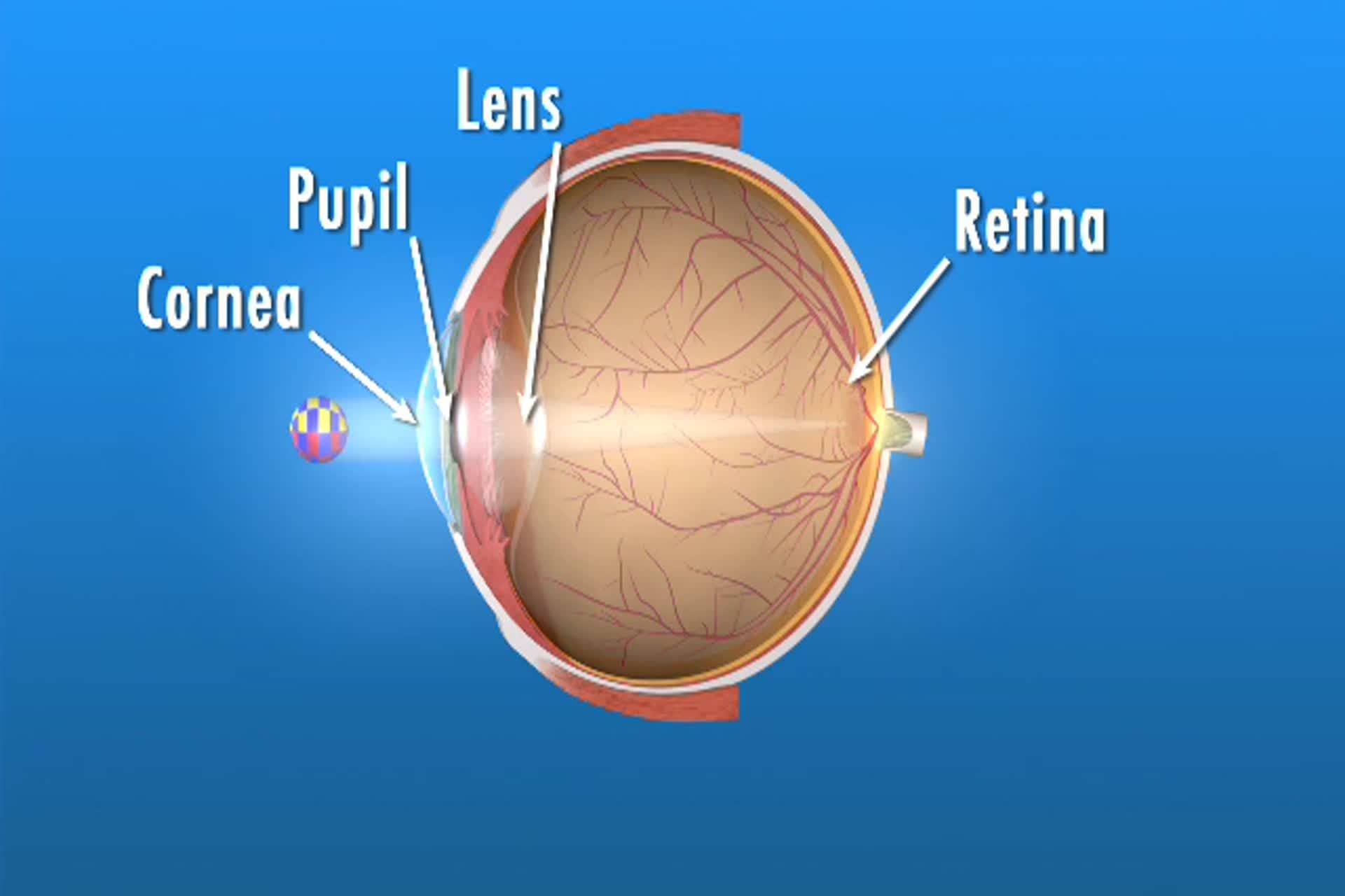 Macular Degeneration - How does macular degeneration affect my eyes?