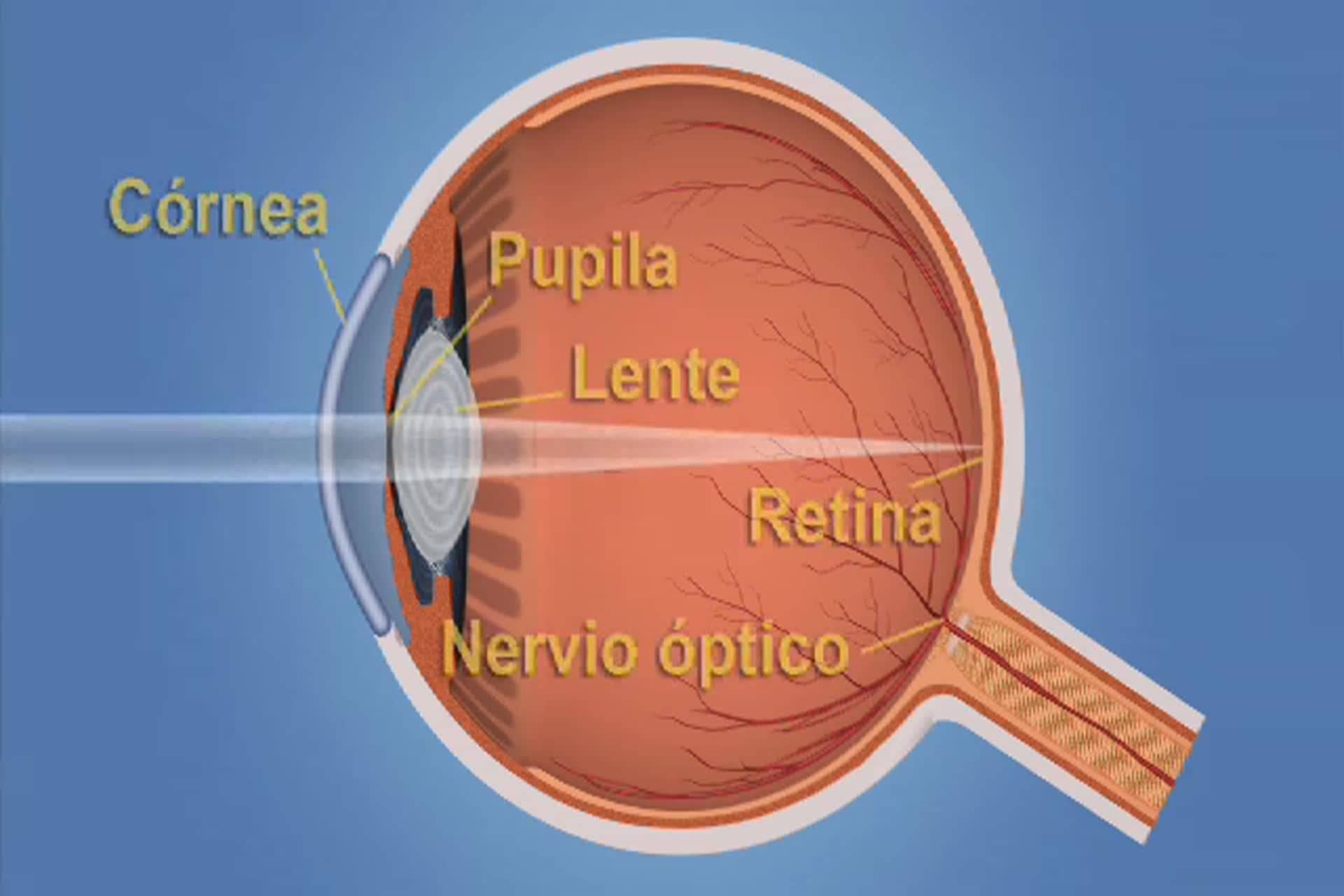 Glaucoma - ¿Cómo ven mis ojos?